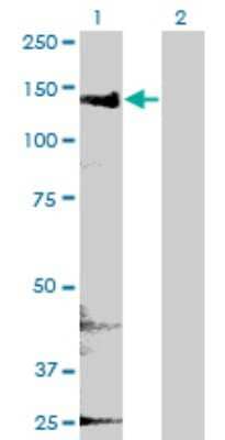 Western Blot: CYFIP2 Antibody (4G6) [H00026999-M01]