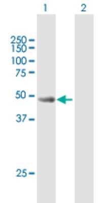 Western Blot: CYLC2 Antibody [H00001539-B01P]