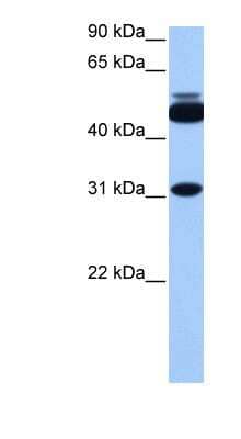 Western Blot: CYLC2 Antibody [NBP1-54921]