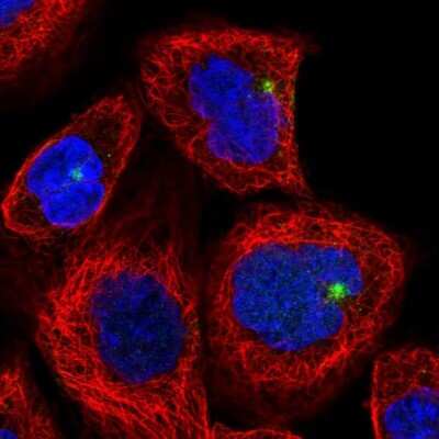 Immunocytochemistry/ Immunofluorescence: CYLD Antibody [NBP2-33589]