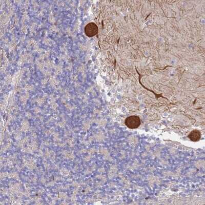 Immunohistochemistry-Paraffin: CYLD Antibody [NBP2-33589]