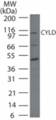 Western Blot: CYLD Antibody [NB100-56461]