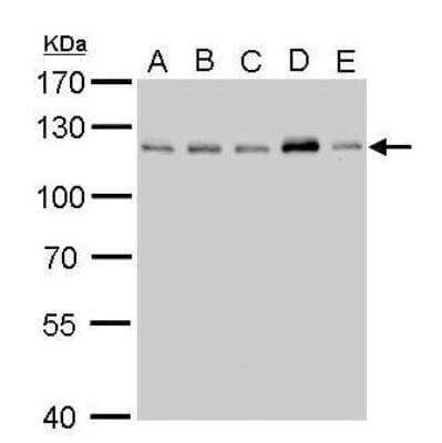 Western Blot: CYLD Antibody [NB100-78600]