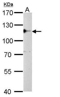 Western Blot: CYLD Antibody [NB100-78600]