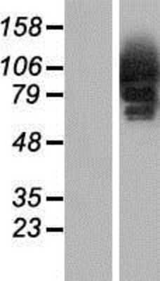 Western Blot: CYLD Overexpression Lysate [NBP2-08356]