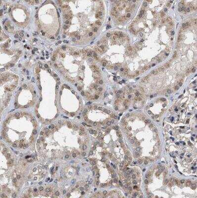 Immunohistochemistry-Paraffin: CYLN2 Antibody [NBP1-85569]