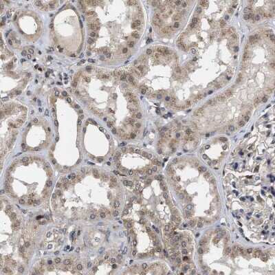 Immunohistochemistry-Paraffin: CYLN2 Antibody [NBP1-85569]