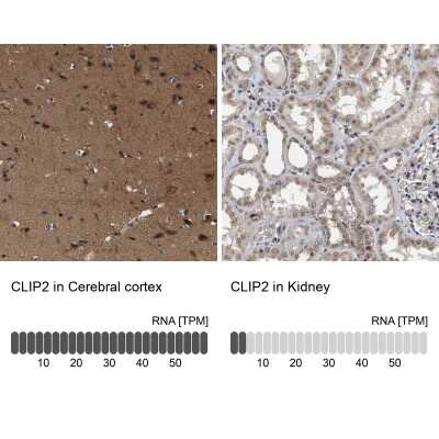 Immunohistochemistry-Paraffin: CYLN2 Antibody [NBP1-85569]