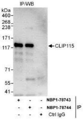 Immunoprecipitation: CYLN2 Antibody [NBP1-78743]