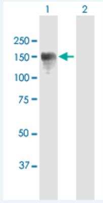 Western Blot: CYLN2 Antibody [H00007461-B01P-50ug]