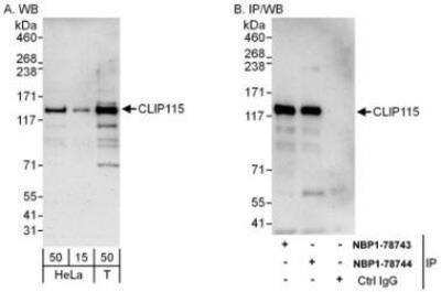 Western Blot: CYLN2 Antibody [NBP1-78744]