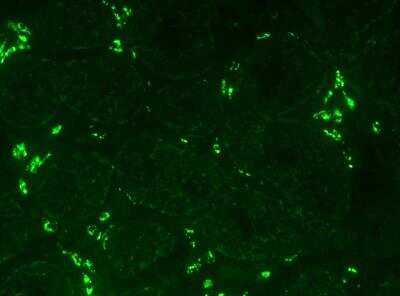 Immunocytochemistry/ Immunofluorescence: CYP11A1 Antibody [NBP1-85368]