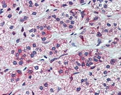 Immunohistochemistry-Paraffin: CYP11A1 Antibody [NBP1-54758]