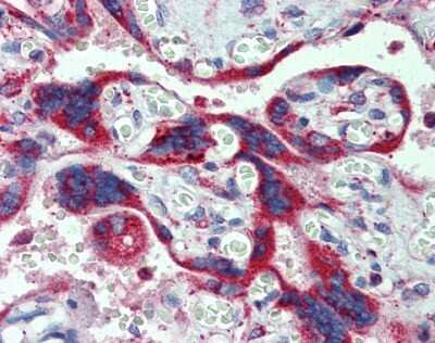 Immunohistochemistry-Paraffin: CYP11A1 Antibody [NBP1-54758]