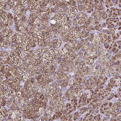 Immunohistochemistry-Paraffin: CYP11A1 Antibody [NBP1-85368]