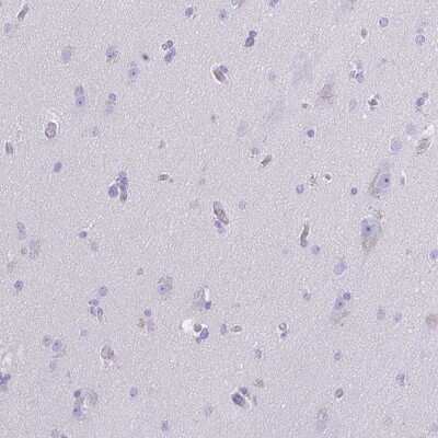 Immunohistochemistry-Paraffin: CYP11A1 Antibody [NBP1-85368]