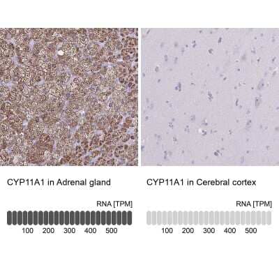 Immunohistochemistry-Paraffin: CYP11A1 Antibody [NBP1-85368]