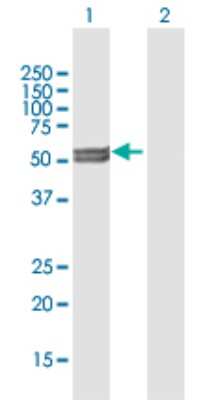 Western Blot: CYP11A1 Antibody [H00001583-B01P]