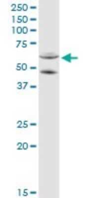 Western Blot: CYP11A1 Antibody [H00001583-D01P]
