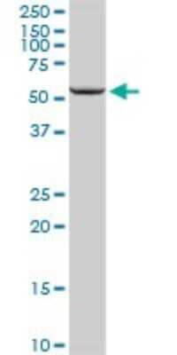 Western Blot: CYP11A1 Antibody [H00001583-D01P]