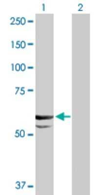 Western Blot: CYP11A1 Antibody [H00001583-D01P]
