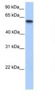 Western Blot: CYP11A1 Antibody [NBP1-54758]
