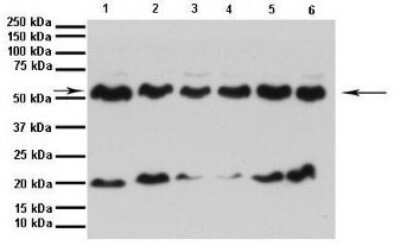 Western Blot: CYP11A1 Antibody [NBP1-54758]