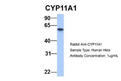 Western Blot: CYP11A1 Antibody [NBP1-54758]