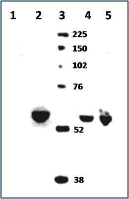 Western Blot: CYP11A1 Antibody [NBP1-85368]