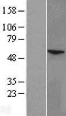 Western Blot: CYP11A1 Overexpression Lysate [NBL1-09669]