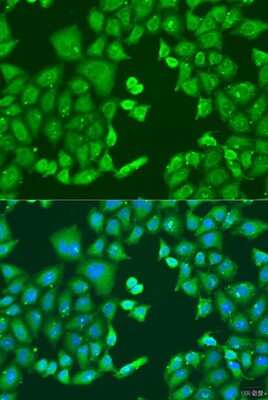 Immunocytochemistry/ Immunofluorescence: CYP11B1 Antibody - BSA Free [NBP3-04876]