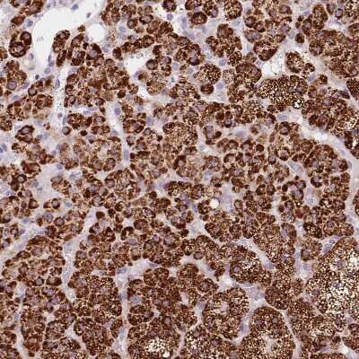 Immunohistochemistry-Paraffin: CYP11B1 Antibody [NBP2-49223]