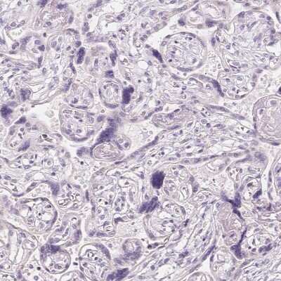 Immunohistochemistry-Paraffin: CYP11B1 Antibody [NBP2-49223]