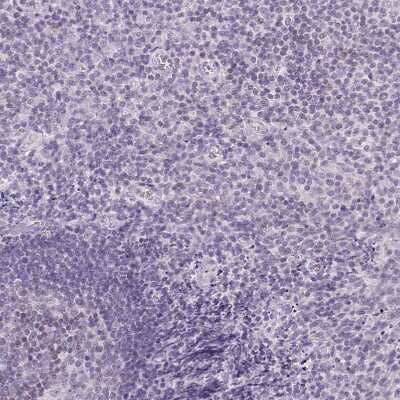 Immunohistochemistry-Paraffin: CYP11B1 Antibody [NBP2-49223]