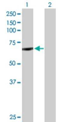 Western Blot: CYP11B1 Antibody [H00001584-D01P]