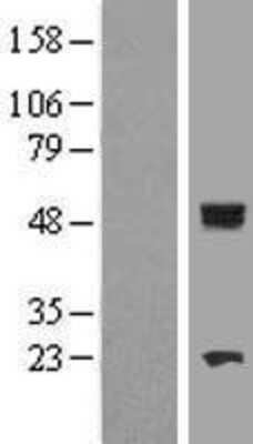 Western Blot: CYP11B1 Overexpression Lysate [NBL1-09671]