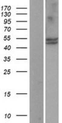 Western Blot: CYP11B1 Overexpression Lysate [NBP2-04159]