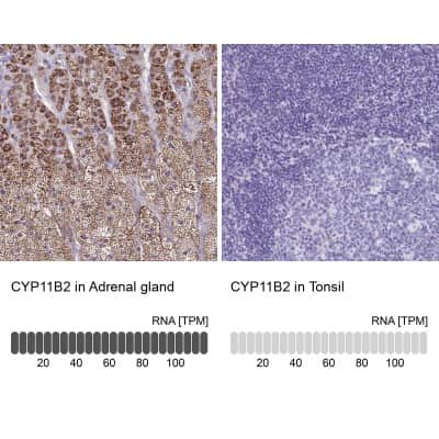 Immunohistochemistry-Paraffin: CYP11B2 Antibody [NBP2-13891]