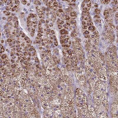 Immunohistochemistry-Paraffin: CYP11B2 Antibody [NBP2-13891]