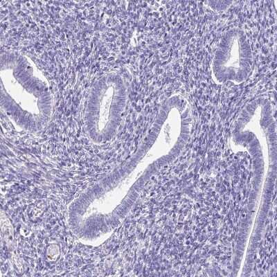 Immunohistochemistry-Paraffin: CYP11B2 Antibody [NBP2-13891]