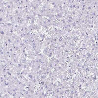 Immunohistochemistry-Paraffin: CYP11B2 Antibody [NBP2-13891]