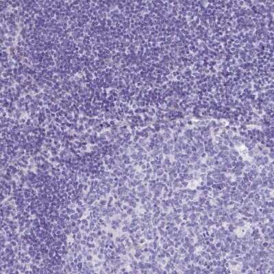 Immunohistochemistry-Paraffin: CYP11B2 Antibody [NBP2-13891]