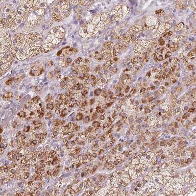 Immunohistochemistry-Paraffin: CYP11B2 Antibody [NBP2-49267]