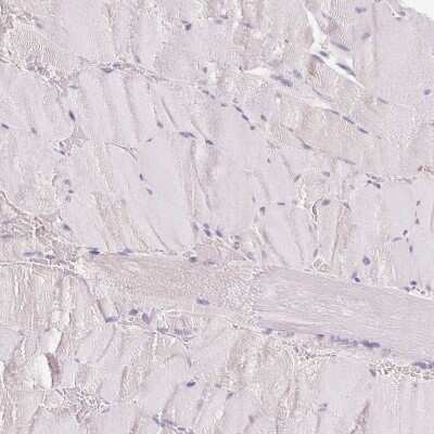 Immunohistochemistry-Paraffin: CYP11B2 Antibody [NBP2-49267]