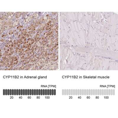 Immunohistochemistry-Paraffin: CYP11B2 Antibody [NBP2-49267]