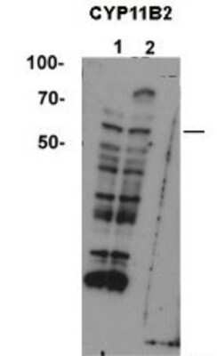 Western Blot: CYP11B2 Antibody [NBP1-56518]