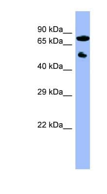 Western Blot: CYP11B2 Antibody [NBP1-56518]