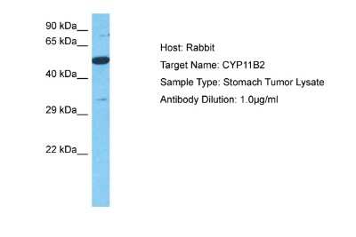 Western Blot: CYP11B2 Antibody [NBP2-87238]