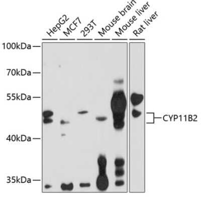 Western Blot: CYP11B2 AntibodyBSA Free [NBP2-92862]