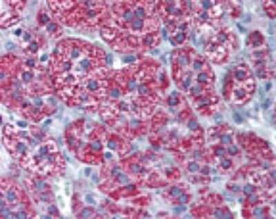 Immunohistochemistry-Paraffin: CYP1B1 Antibody [NBP2-24722]